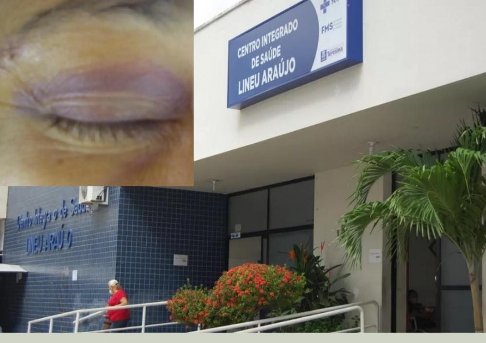 Técnica em enfermagem é agredida por paciente no Hospital Lineu Araújo, em Teresina
