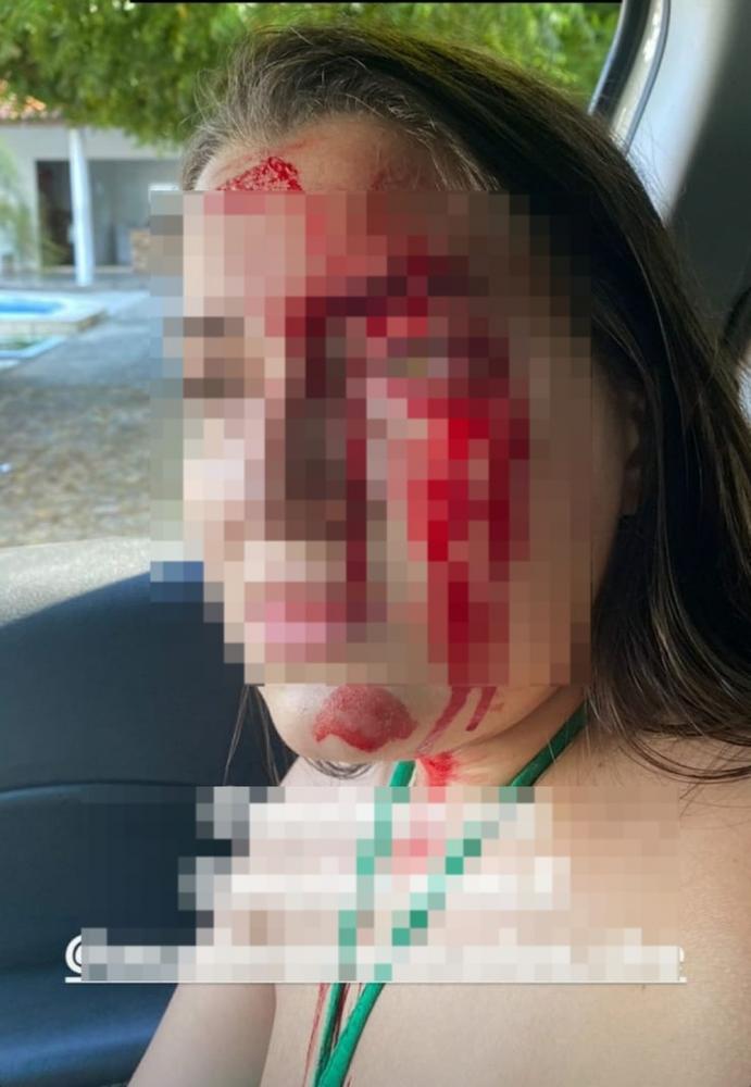 Vítima denuncia namorado e chora ao falar da dificuldade para perceber violência: 'eu não conseguia ver como agressor'