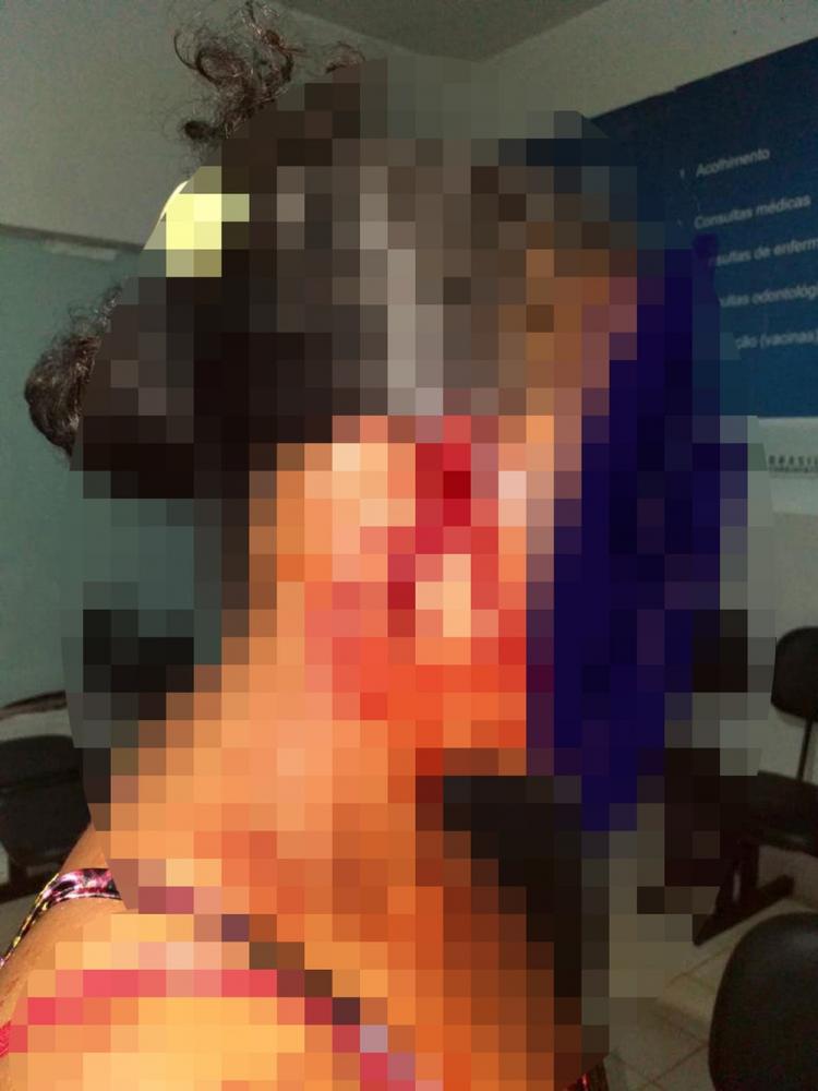 Crianças ligam para a polícia e pedem socorro ao ver a mãe sendo esfaqueada pelo tio no Piauí