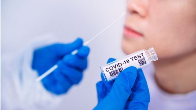 Piauí registra 365 casos e 2 óbitos por Covid-19, segundo dados da SESAPI