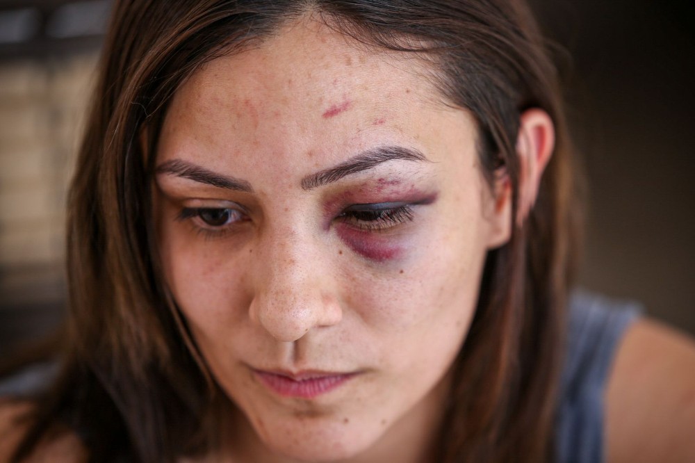 Enfermeira denuncia servidor do Tribunal de Justiça do Piauí por agressão