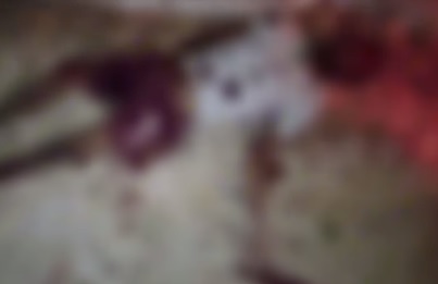 Homem é baleado com vários tiros no conjunto Zé Pereira em Floriano