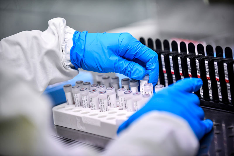 Taxa de positividade do Covid-19 aumenta pela sexta semana consecutiva no Piauí