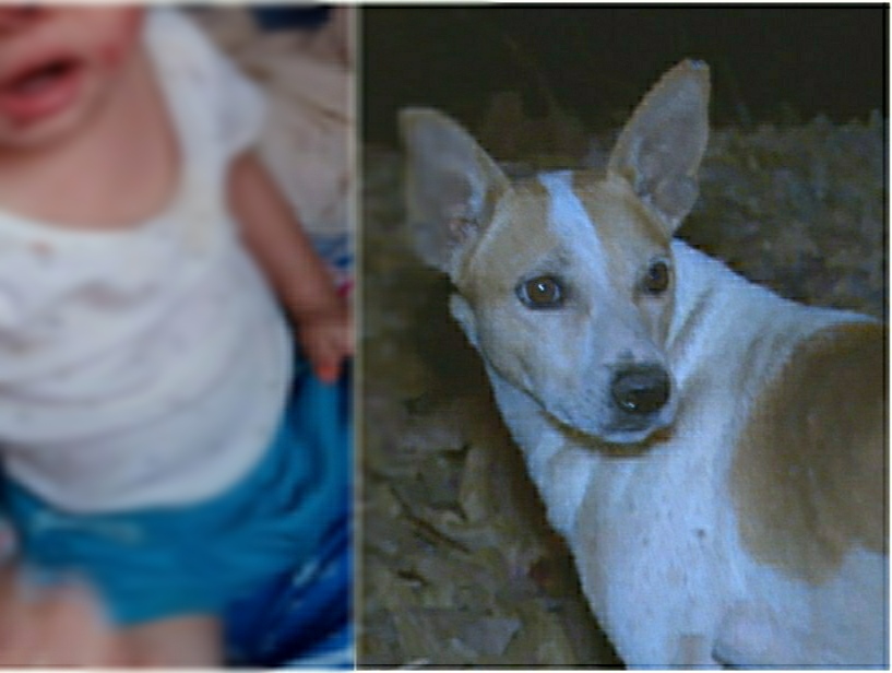 Criança de 1 ano vai parar no Hospital após mordida de cachorro
