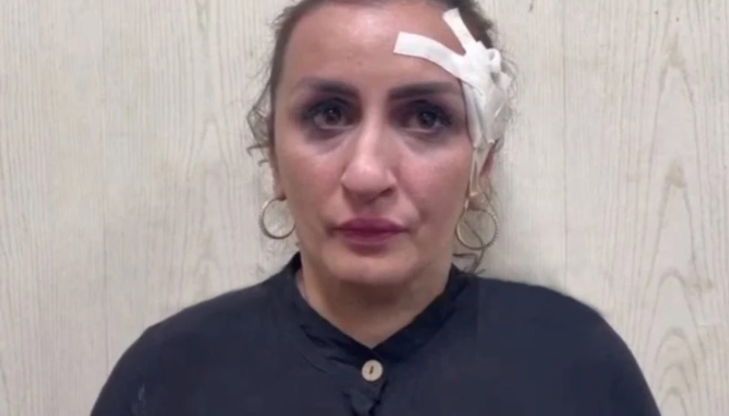 Mulher é presa acusada de vender bebê para pagar plástica no nariz