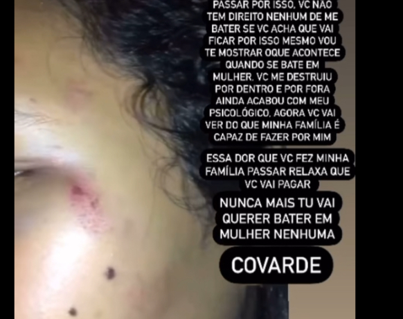 Jovem de Floriano denuncia ex-namorado por agressão em Barão de Grajaú-MA