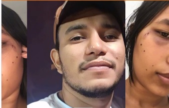 Saiba quem é o acusado de agressão a jovem florianense, ocorrido na cidade de Barão de Grajaú-MA 